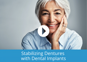 Link opens a video - Stabilizing Dentures with Dental Implants